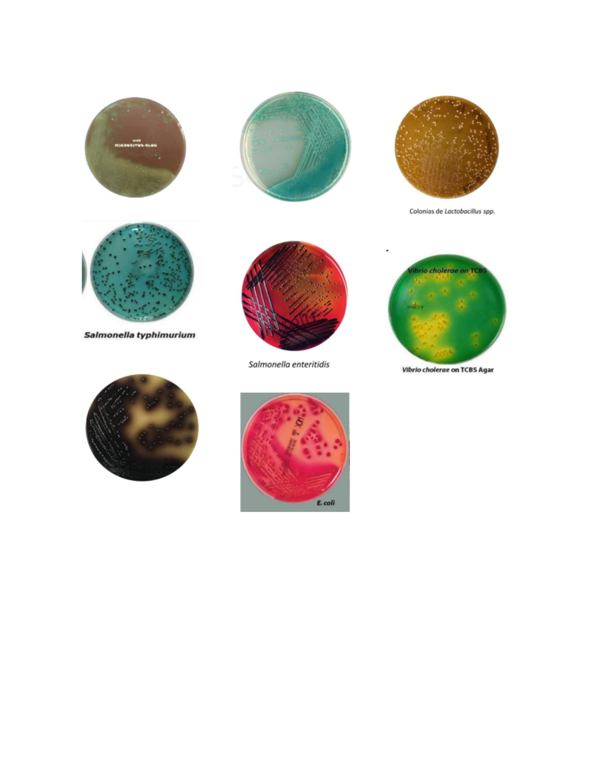Bacter Imagenes - Bacteriología - web MICROBITOS-BLOG Colonias de ...
