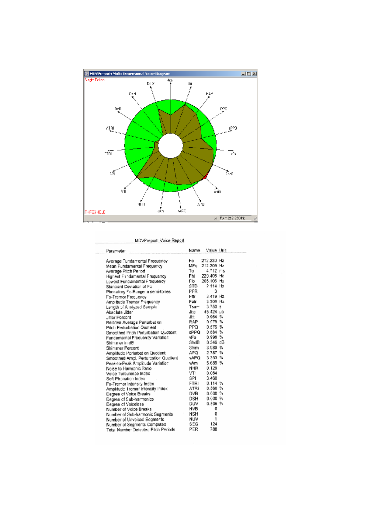 MDVP Report: Voice Parameters Analysis for Fo 212.230 Hz - Studocu