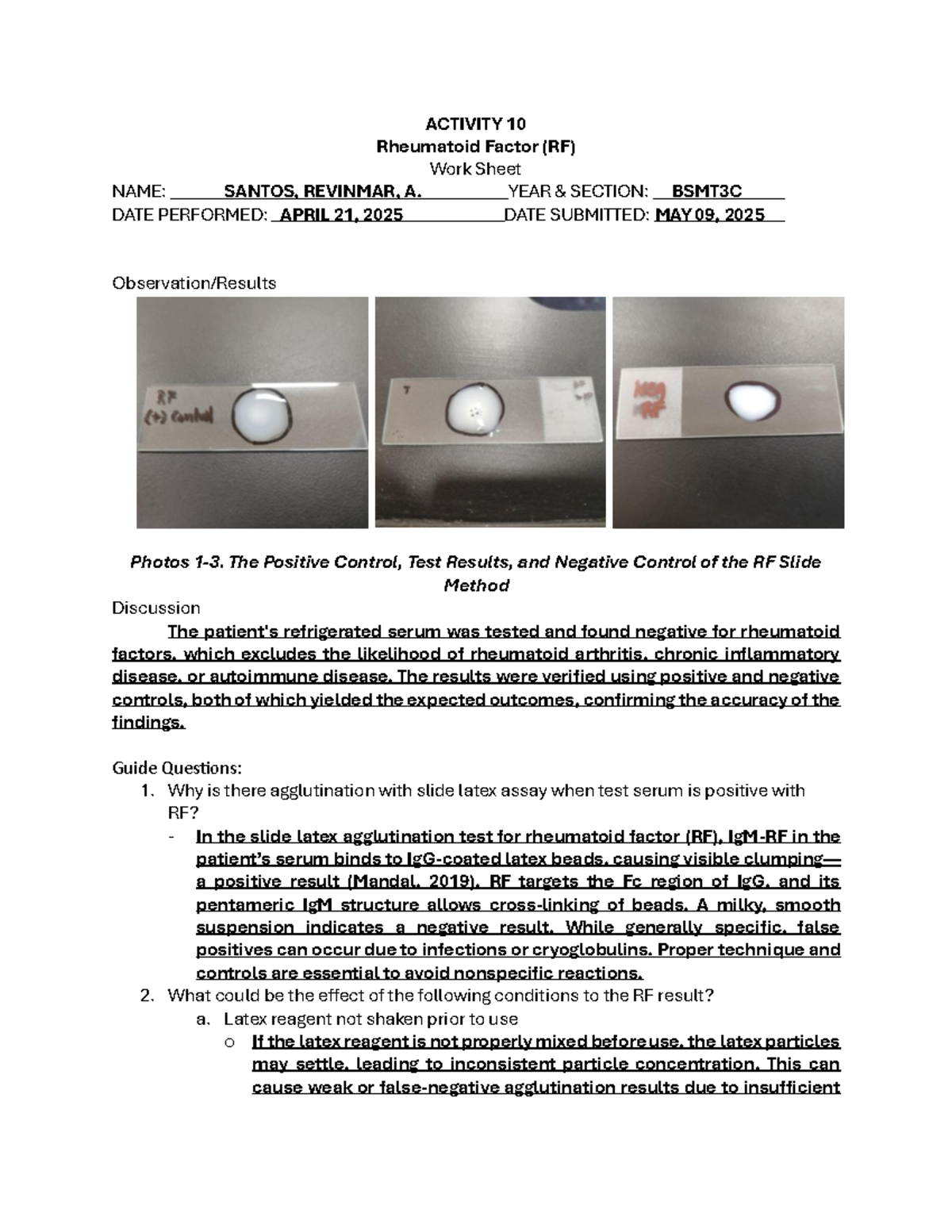 ACTIVITY 10: Rheumatoid Factor (RF) Lab Worksheet - Santos BSMT3C - Studocu