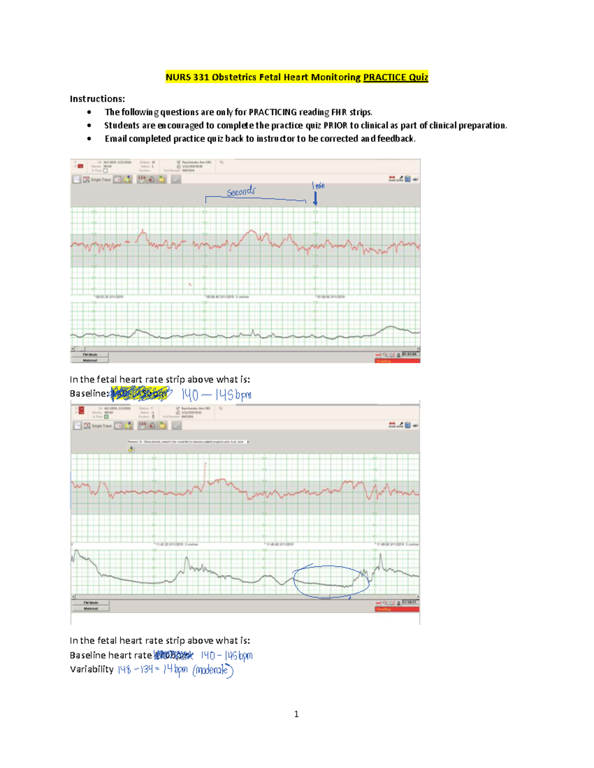 NURS 331 Obstetrics Fetal Heart Monitoring Practice Quiz Guide - Studocu