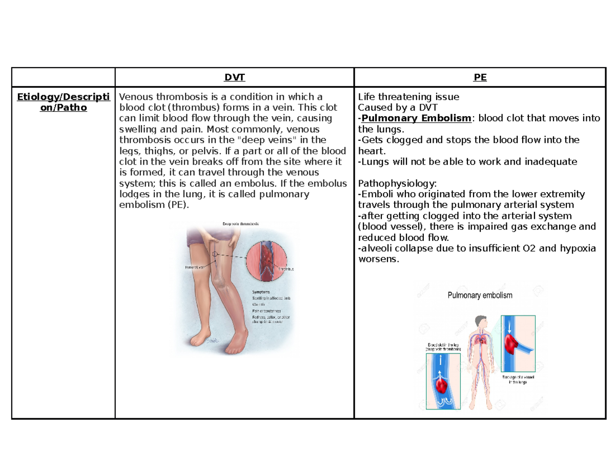 DVT PE map - DVT/PE Concept Notes for Nclex - DVT PE Etiology ...