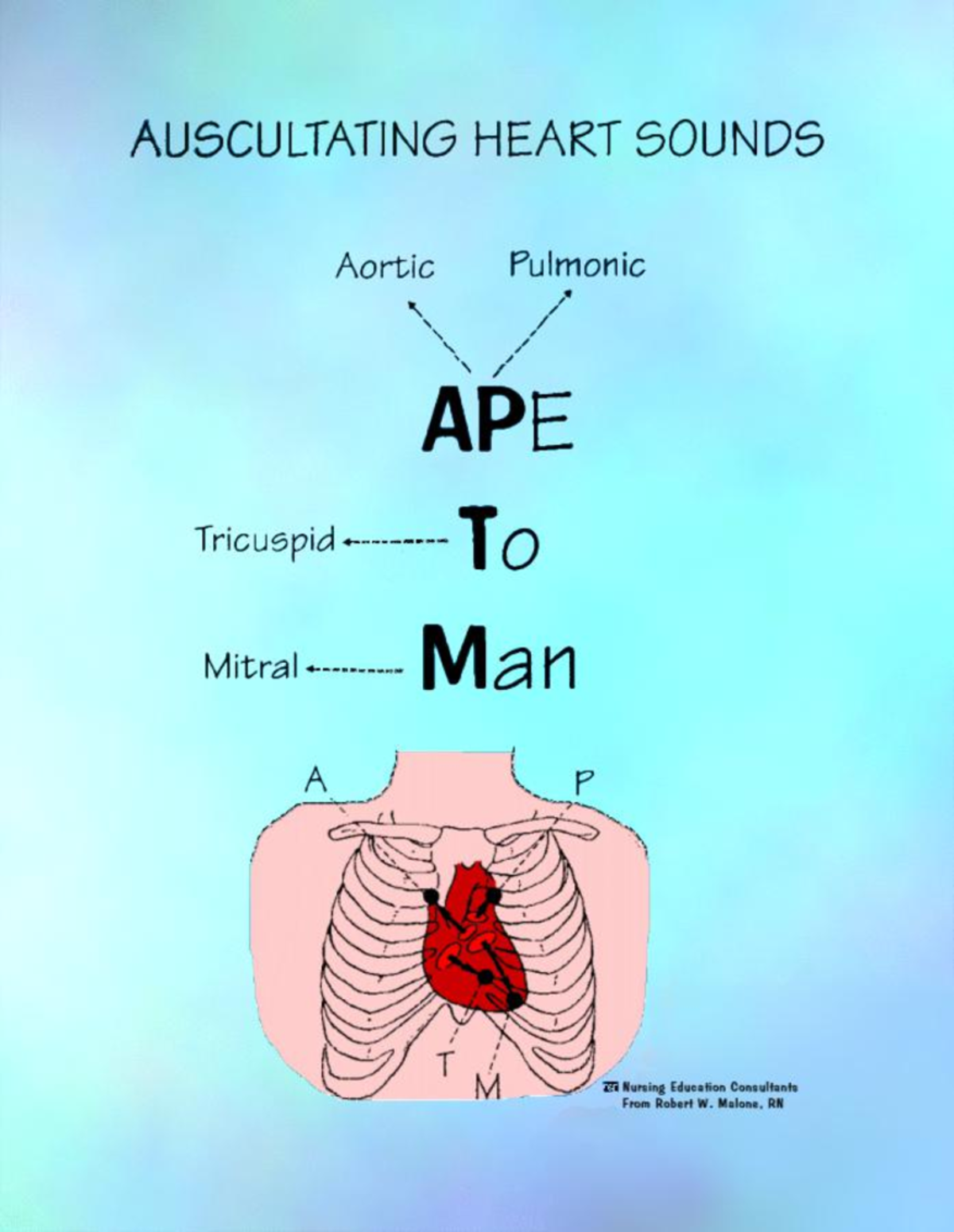 AUSCULTATING HEART SOUNDS & MYOCARDIAL INFARCTION: Nursing Flashcards ...