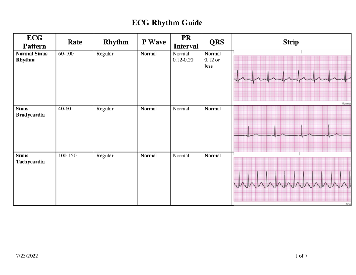 ECG Rhythm Guide: Patterns and Interpretations for Telemetry - Studocu