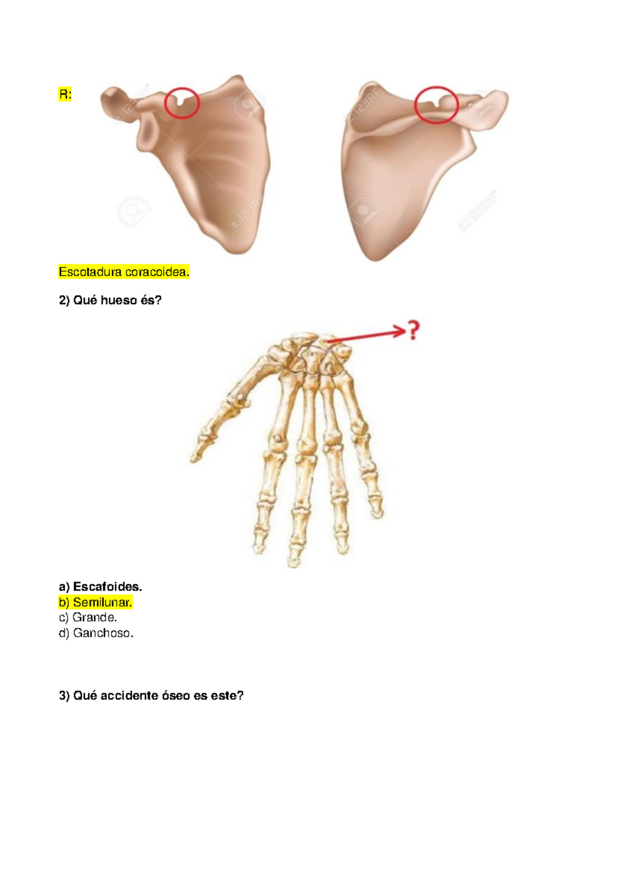 R: Anatomía del Húmero y Estructuras Relacionadas - Estudio 2023 - Studocu