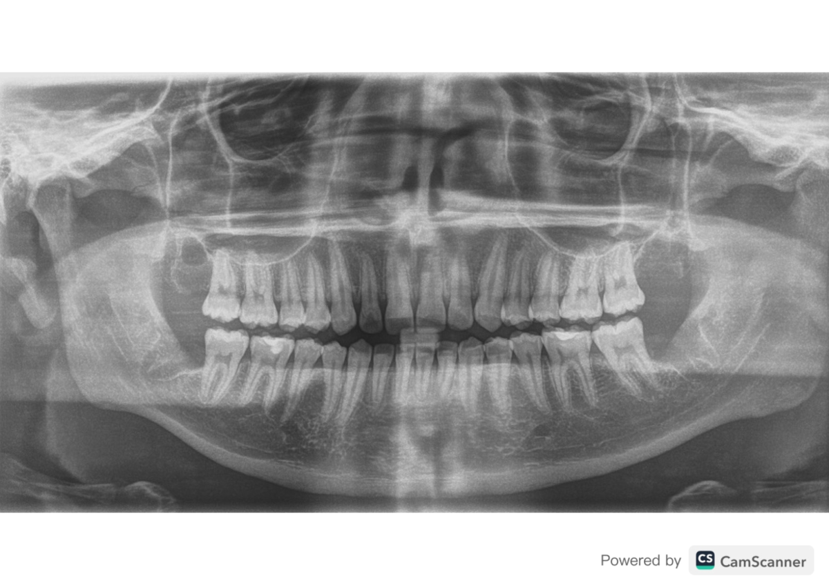 Panorex Dental - Esta panoramica remite reivision - salud ocupacional ...