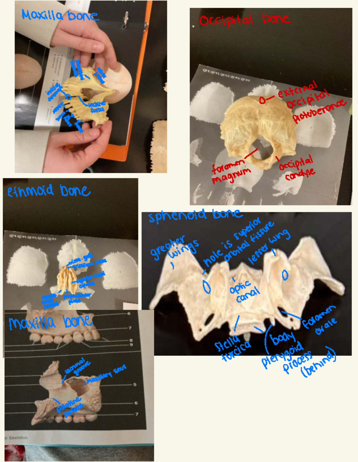 Anatomy Lab Notes: Maxilla and Related Bones - Studocu