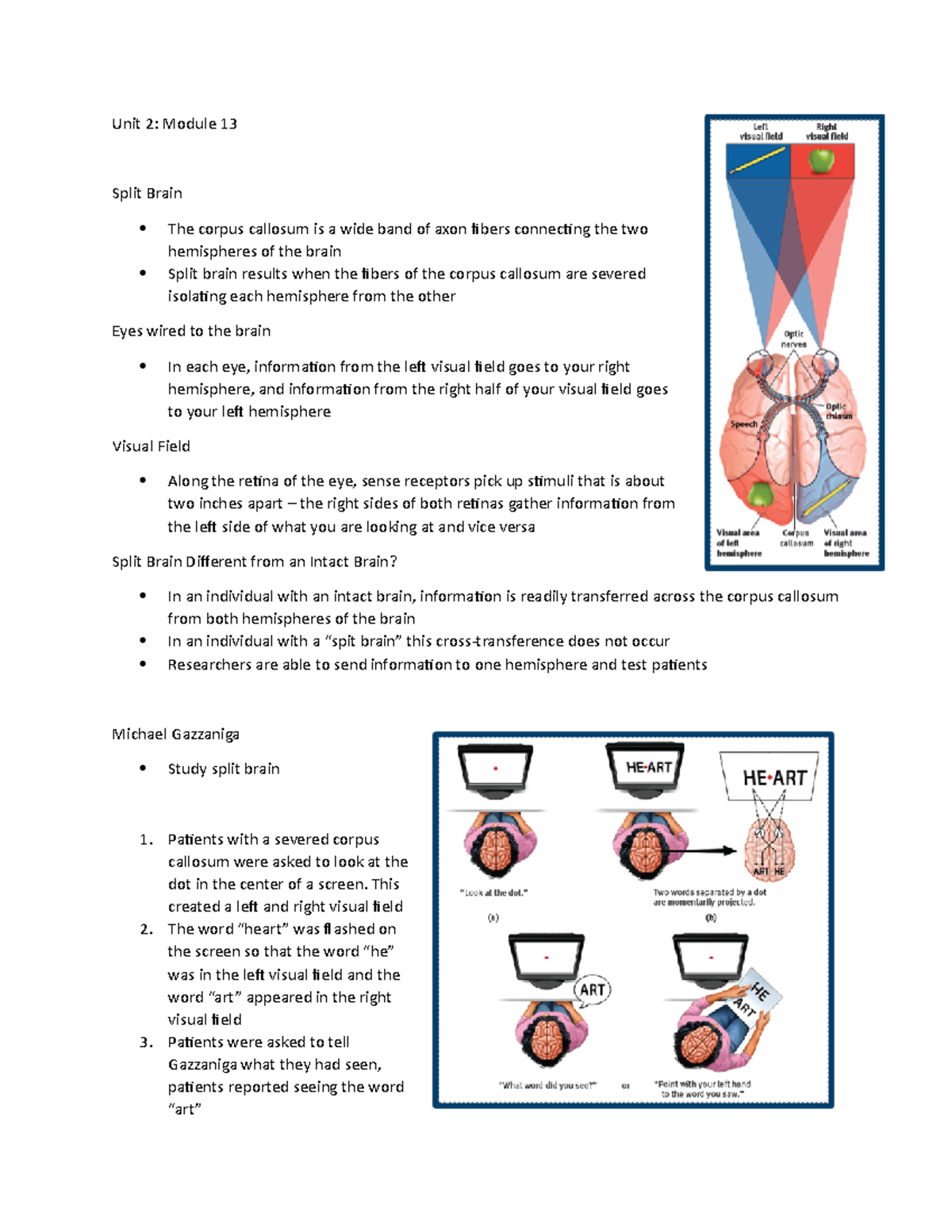 Unit 2 Module 13 - Understanding Split Brain and Visual Processing ...
